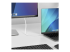 StarTech.com 6.6ft (2m) USB C to DisplayPort 1.2 Cable, Bidirectional - Närbild